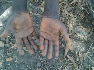 Les mains ouvertes d’un enfant noir tendues vers le ciel, sous les branches des arbres.