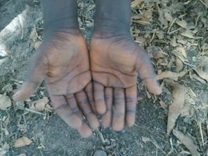 Les mains ouvertes d’un enfant noir tendues vers le ciel, sous la couverture d’arbres.