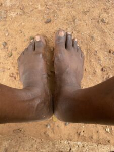 Pieds nus d’un adulte sur un sol naturel