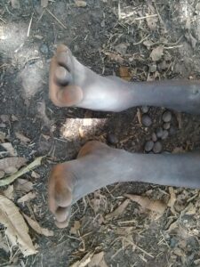 Un enfant assis par terre sous un arbre, les pieds sales, dans un cadre tranquille d'Afrique. L'ombre de l'arbre lui apporte un peu de fraîcheur.