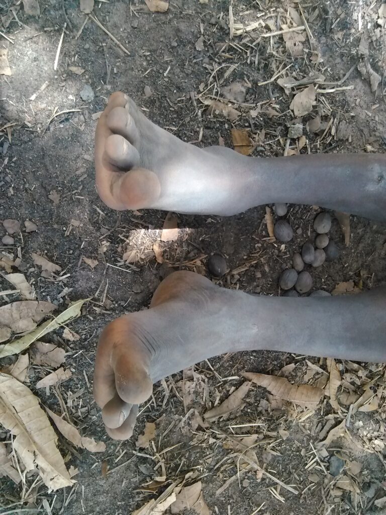 Un enfant assis par terre sous un arbre, les pieds sales, dans un paysage paisible d'Afrique. L'ombre de l'arbre lui apporte de la fraîcheur et de la tranquillité.