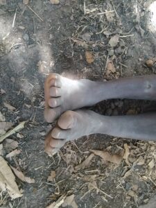 Un enfant assis par terre sous un arbre, les pieds sales, dans un paysage calme d'Afrique. L'ombre de l'arbre lui procure un moment de fraîcheur.