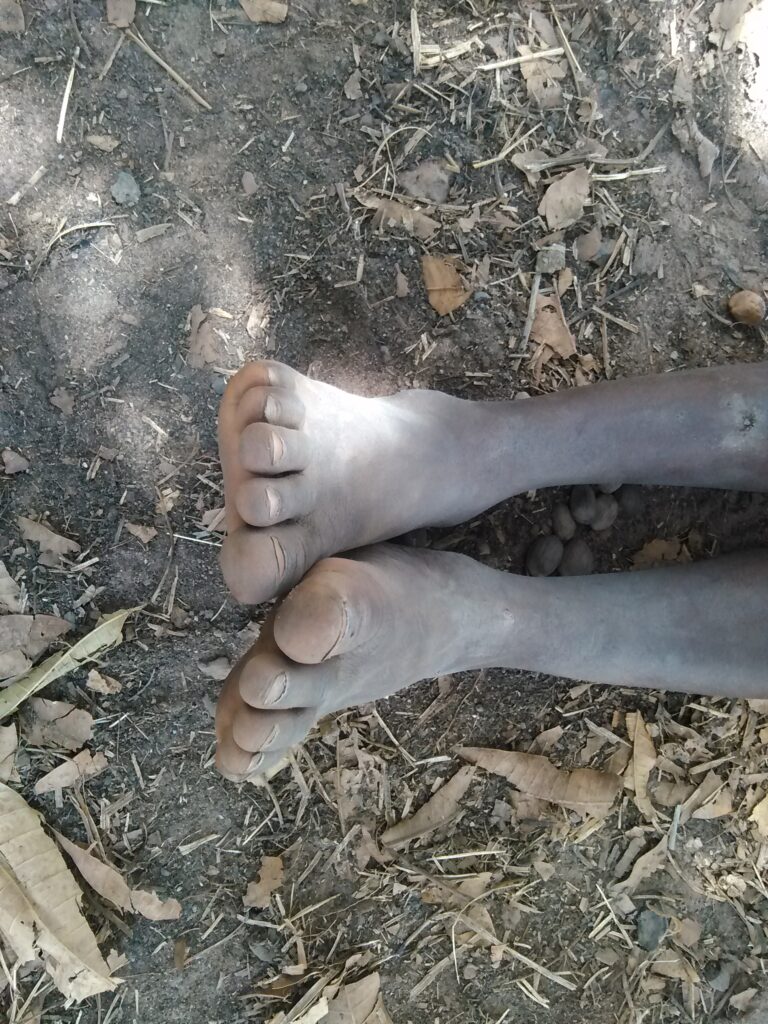 Un enfant assis par terre sous un arbre, les pieds sales, dans un paysage tranquille d'Afrique. L'ombre de l'arbre lui offre un moment de répit.