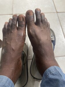 Pied nu d'un adulte africain posé sur un sol, montrant la texture de la peau et du terrain environnant.