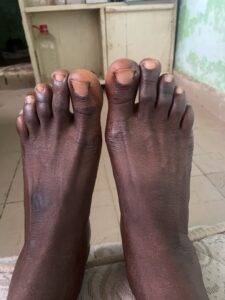 Pied nu d'un adulte africain reposant sur le sol, montrant la texture de la peau et du sol environnant.